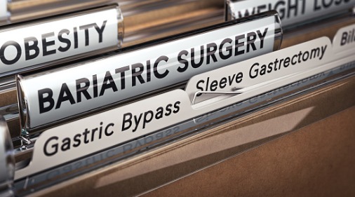 Key differences between gastric sleeve and gastric bypass surgery